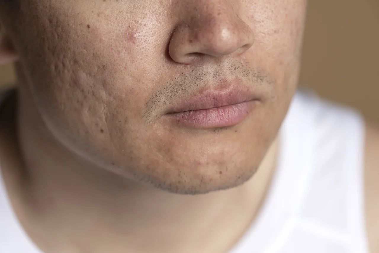 Close up skin pores face care routine